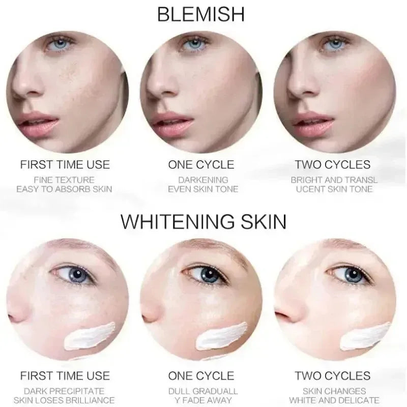 Creme Anti-Manchas com Niacinamida – Uniformiza e Ilumina a Pele